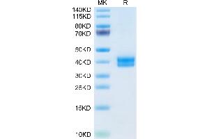 Mouse CADM3 on Tris-Bis PAGE under reduced condition. (CADM3 Protein (AA 23-328) (His tag))
