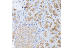 Immunohistochemistry of paraffin-embedded mouse pancreas using PLG1B antibody (ABIN6129428, ABIN6145724, ABIN6145725 and ABIN6221143) at dilution of 1:100 (40x lens). (PLA2G1B Antikörper  (AA 23-148))