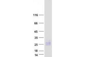Validation with Western Blot (PMP22 Protein (Transcript Variant 1) (Myc-DYKDDDDK Tag))
