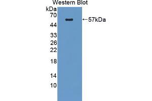 Western blot analysis of the recombinant protein. (PLEKHA1 Antikörper  (AA 105-351))
