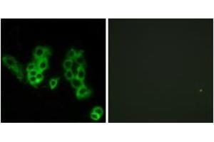 Immunofluorescence analysis of MCF7 cells, using Encephalopsin Antibody. (OPN3 Antikörper  (AA 161-210))