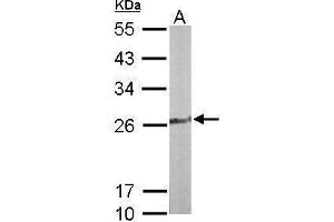 WB Image Sample (50 ug of whole cell lysate) A: Mouse liver 12% SDS PAGE antibody diluted at 1:1000 (TPK1 Antikörper)