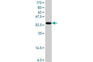 Western Blot detection against Immunogen (37 KDa) . (CYP4F3 Antikörper  (AA 100-198))