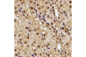 Immunohistochemical analysis of SMYD1 staining in rat kidney formalin fixed paraffin embedded tissue section. (SMYD1 Antikörper)