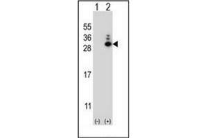 Western blot analysis of MOBKL1B (arrow) using MOBKL1B Antibody (N-term) Cat. (MOB1A Antikörper  (N-Term))