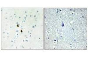 Immunohistochemistry analysis of paraffin-embedded human brain tissue, using TPD52 antibody.