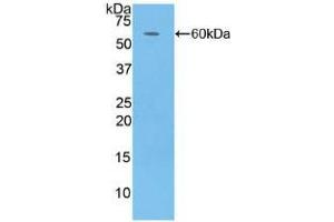 Western blot analysis of recombinant Human CFD. (Adipsin Antikörper  (AA 1-253))