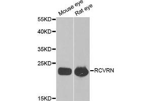 Western blot analysis of extracts of various cell lines, using RCVRN antibody (ABIN5973805) at 1/1000 dilution. (Recoverin Antikörper)