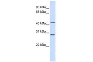 Image no. 1 for anti-Ribosomal Protein L3 (RPL3) (AA 36-85) antibody (ABIN6741022) (RPL3 Antikörper  (AA 36-85))