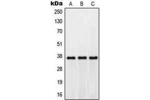 Western blot analysis of GPR171 expression in Jurkat (A), mouse kidney (B), H9C2 (C) whole cell lysates. (GPR171 Antikörper  (Center))