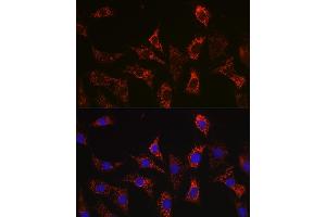 Immunofluorescence analysis of C6 cells using Bax Rabbit mAb  at dilution of 1:100 (40x lens). (BAX Antikörper)