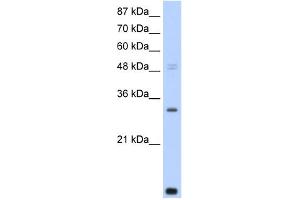 WB Suggested Anti-CNOT7 Antibody Titration:  0. (CNOT7 Antikörper  (N-Term))