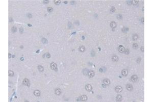 Immunohistochemistry (IHC) image for anti-Intersectin 1 (ITSN1) (AA 1-227) antibody (ABIN7444238)