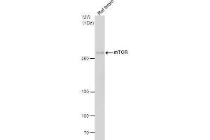 WB Image mTOR antibody [C1], Internal detects mTOR protein by western blot analysis. (MTOR Antikörper  (Internal Region))