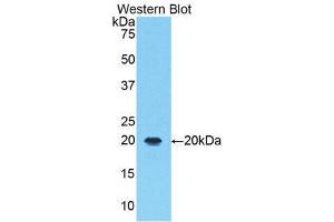 Western Blotting (WB) image for anti-Arachidonate 5-Lipoxygenase (ALOX5) (AA 374-536) antibody (ABIN1174531)