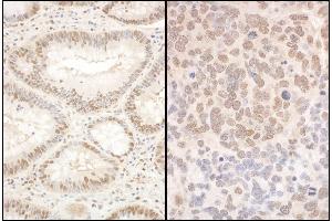 anti-Polyglutamine Binding Protein 1 (PQBP1) (AA 150-200) antibody