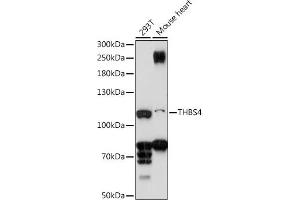 Western blot analysis of extracts of various cell lines, using THBS4 antibody (ABIN7270818) at 1:1000 dilution. (THBS4 Antikörper  (AA 27-300))