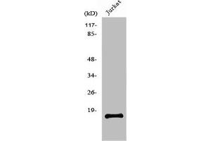 Western Blot analysis of Jurkat cells using PDGF-A Polyclonal Antibody (PDGFA Antikörper  (Internal Region))
