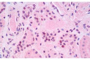 Immunohistochemistry analysis of paraffin-embedded Human Kidney using RELB Polyclonal Antibody. (RELB Antikörper)
