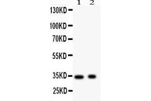Anti- Synaptophysin Picoband antibody, Western blottingAll lanes: Anti Synaptophysin  at 0. (Synaptophysin Antikörper  (N-Term))