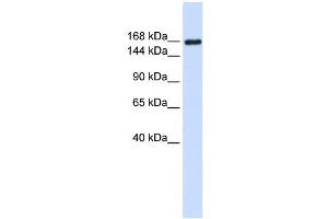 Laminin Gamma 1 antibody used at 1 ug/ml to detect target protein.