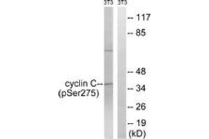 Western blot analysis of extracts from NIH-3T3 cells treated with UV 15', using Cyclin C (Phospho-Ser275) Antibody. (Cyclin C Antikörper  (pSer275))