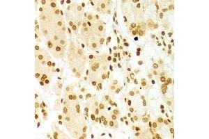 Immunohistochemistry of paraffin-embedded human stomach using DKC1 Antibody (ABIN5970956) at dilution of 1/100 (40x lens). (DKC1 Antikörper)