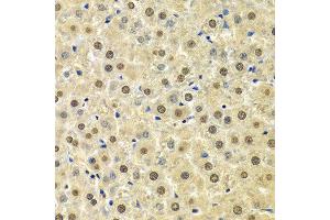 Immunohistochemistry (IHC) image for anti-Sphingosine Kinase 1 (SPHK1) (AA 50-384) antibody (ABIN3020648)