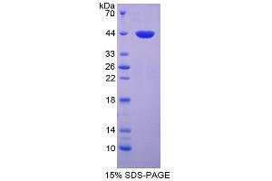 SDS-PAGE analysis of Rat Lipocalin 12 Protein.