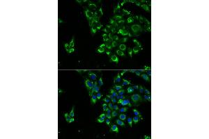 Immunofluorescence analysis of U2OS cells using TSHB antibody.