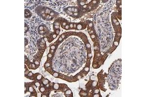 Immunohistochemical staining of human small intestine with ZNF780B polyclonal antibody  shows strong cytoplasmic and membranous positivity in glandular cells at 1:20-1:50 dilution. (ZNF780B Antikörper)