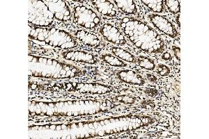 IHC analysis of DDX5 using anti-DDX5 antibody (ABIN7602561). (DDX5 Antikörper  (AA 85-328))