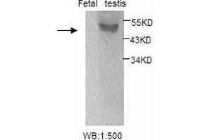 Image no. 1 for anti-Estrogen Receptor 2 (ESR2) antibody (ABIN790795) (ESR2 Antikörper)