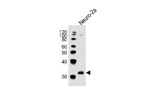 Anti-EN2Antibody (C-term)at 1:1000 dilution + Neuro-2a whole cell lysates Lysates/proteins at 20 μg per lane. (EN2 Antikörper  (C-Term))