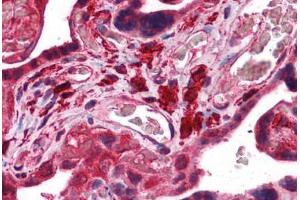 Human Placenta: Formalin-Fixed, Paraffin-Embedded (FFPE) (Fukutin Antikörper  (AA 272-456))