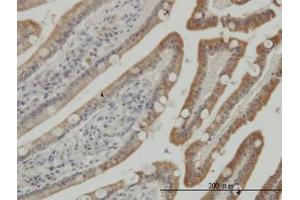 Image no. 3 for anti-Casein Kinase 1, gamma 1 (CSNK1G1) (AA 293-393) antibody (ABIN599256) (CSNK1G1 Antikörper  (AA 293-393))