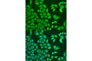 Immunofluorescence analysis of U2OS cells using CAPZB antibody. (CAPZB Antikörper  (AA 1-272))