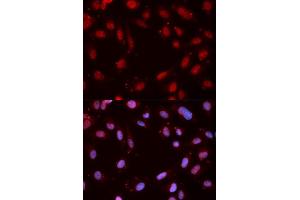 Immunofluorescence analysis of MCF7 cell using Phospho-CHEK1-S280 antibody. (CHEK1 Antikörper  (pSer280))