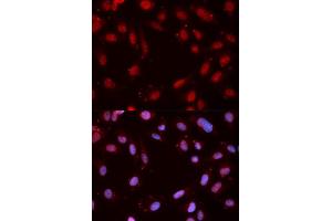 Immunofluorescence analysis of MCF7 cell using Phospho-CHEK1-S280 antibody.
