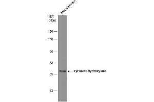 WB Image Mouse tissue extract (50 μg) was separated by 7. (Tyrosine Hydroxylase Antikörper)