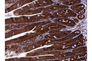 Immunohistochemistry (IHC) image for anti-Tight Junction Protein 1 (TJP1) (N-Term) antibody (ABIN2856624)