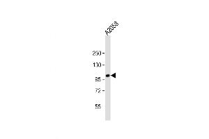 Western Blot at 1:2000 dilution + A2058 whole cell lysate Lysates/proteins at 20 ug per lane. (ADAMTS17 Antikörper  (N-Term))