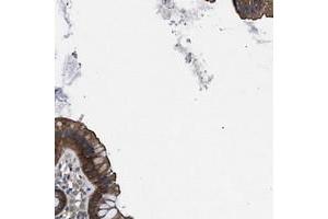 Immunohistochemical staining of human colon with TRIP4 polyclonal antibody  shows cytoplasmic positivity in glandular cells.