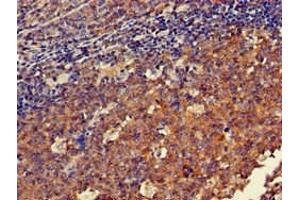 Immunohistochemistry of paraffin-embedded human tonsil tissue using ABIN7150570 at dilution of 1:100 (DOK3 Antikörper  (AA 1-146))