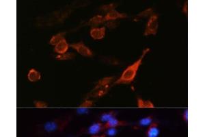 Immunofluorescence analysis of NIH-3T3 cells using CD98 Polyclonal Antibody at dilution of 1:100 (40x lens). (SLC3A2 Antikörper)