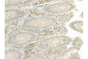 ABIN6259487 and ABIN6275046 at 1/100 staining human normal colon tissue by IHC-P. (ATG4D Antikörper  (C-Term))