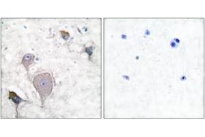 Immunohistochemistry analysis of paraffin-embedded human brain tissue, using Peripherin Antibody. (Peripherin Antikörper  (AA 421-470))