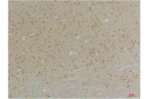 Immunohistochemistry (IHC) analysis of paraffin-embedded Rat Brain Tissue using GABA A Receptor alpha4 Rabbit Polyclonal Antibody diluted at 1:200. (GABRA4 Antikörper)