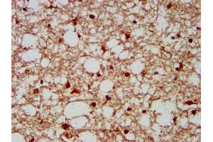 IHC image of ABIN7155695 diluted at 1:300 and staining in paraffin-embedded human brain tissue performed on a Leica BondTM system. (GBX2 Antikörper  (AA 65-248))