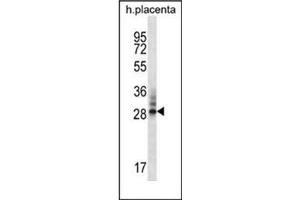 Western blot analysis of DNAJC27 / RBJ Antibody (N-term) in human placenta tissue lysates (35ug/lane). (DNAJC27 Antikörper  (N-Term))